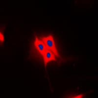 Polyclonal Rabbit anti-Human TBC1D4 / AS160 Antibody (phospho-Thr642, IHC, IF, WB)