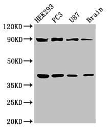 TRIM54 / MURF Antibody