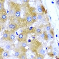 UGT1A9 Antibody