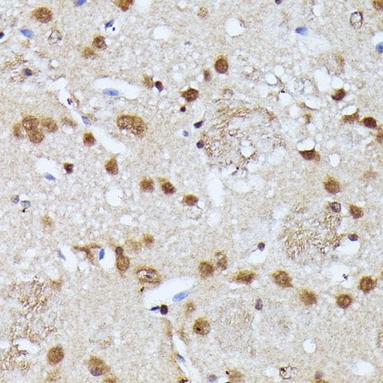 Polyclonal Rabbit anti-Human KIAA1429 Antibody (IHC)