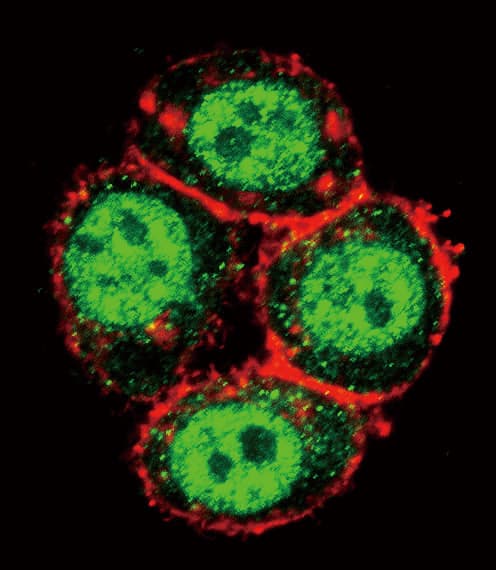 Polyclonal Rabbit anti-Human PAK1 Antibody (Thr423, IHC, IF, WB)