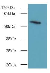 GDPD2 / GDE3 Antibody