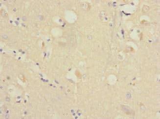 RAP2B Antibody