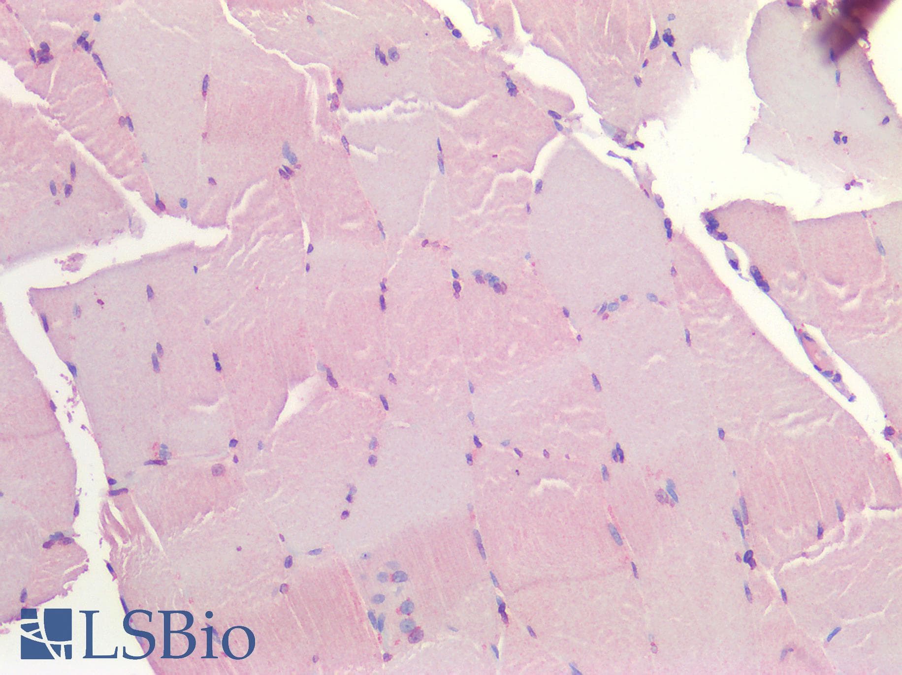 IHC-plus™ IGF1R / IGF1 Receptor Antibody