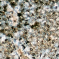 Polyclonal Rabbit anti-Human LIPE / HSL Antibody (phospho-Ser552, IHC, WB)