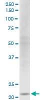 Monoclonal Mouse anti-Human NDUFV2 Antibody (clone 1A10, WB)