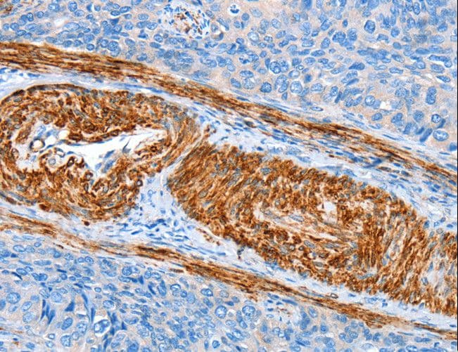Polyclonal Rabbit anti-Human AARS Antibody (IHC)
