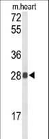 Polyclonal Rabbit anti-Human TSPAN1 / TM4SF Antibody (aa140-167, IHC, WB)