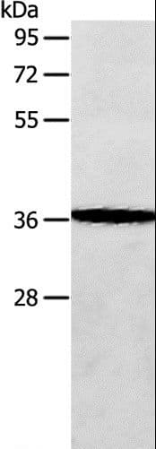 Polyclonal Rabbit anti-Human AASDHPPT / LYS5 Antibody (IHC, WB)