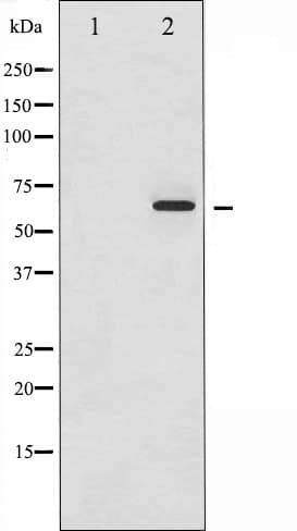 SMAD1 Antibody (phospho-Ser465)