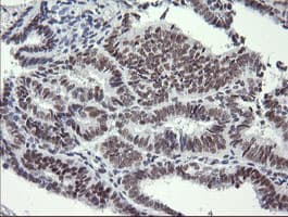 SOLO / SESTD1 Antibody (clone OTI2E7)