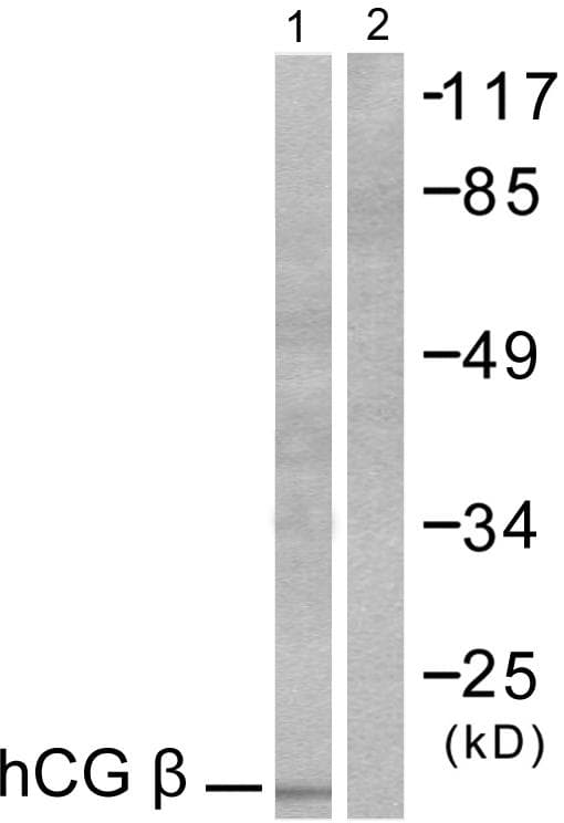 CGB / hCG Beta Antibody