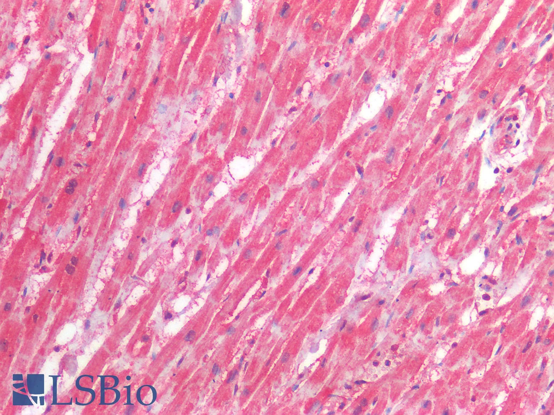 PathPlus™ CRBN / Cereblon Antibody