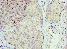 SEPT6 / Septin 6 Antibody (aa350-434)