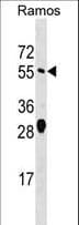 ARFGAP2 / ZNF289 Antibody (aa276-305)