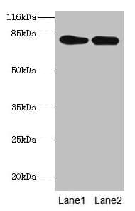 LHCGR / LHR / LH Receptor Antibody (aa27-363)