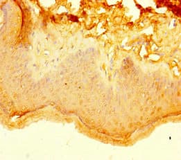 KRT40 / Hair Keratin KA36 Antibody