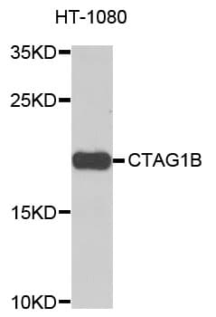 IHC-plus™ Polyclonal Rabbit anti-Human CTAG1B / NY-ESO-1 Antibody (IHC, WB)