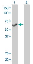 PPP3CB Antibody (clone 5D3)