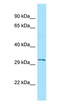 EDNRA / Endothelin A Receptor Antibody (C-Terminus)