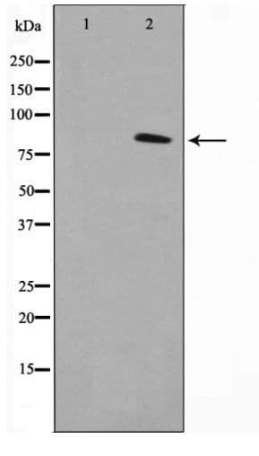 NR3C1/Glucocorticoid Receptor Antibody (phospho-Ser226)