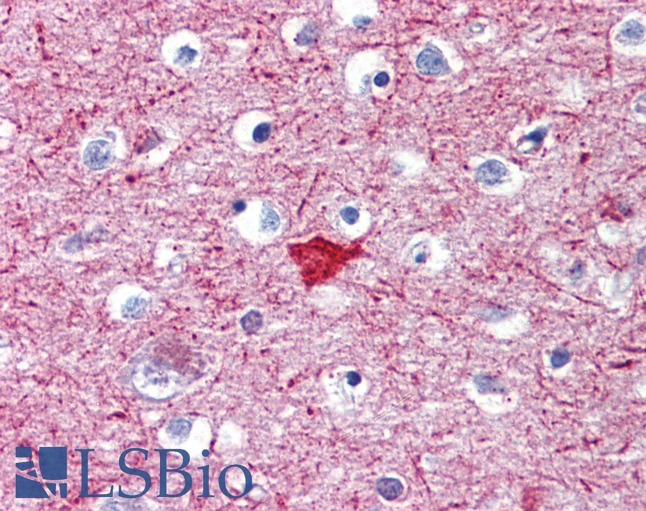 IHC-plus™ MEF2C Antibody (Ser396)