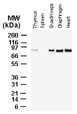 Polyclonal Rabbit anti-Human BAG3 / BAG-3 Antibody (C-Terminus, IHC, WB)