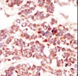 Polyclonal Rabbit anti-Human CCK4 / PTK7 Antibody (aa21-52, IHC, WB)