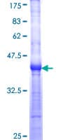 Human WRN Protein (Recombinant GST, N-terminus)