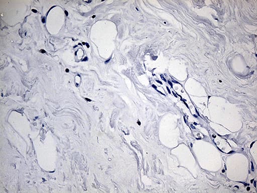 Monoclonal Mouse anti-Human ACAA1 Antibody (clone OTI4F1, IHC, WB)