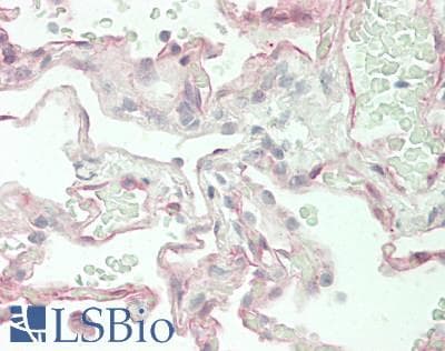 IHC-plus™ ASAP1 Antibody (aa750-800)
