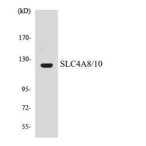 SLC4A8+10 Antibody (aa369-418)