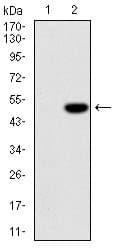 Monoclonal Mouse anti-Human IL-1B / IL-1 Beta Antibody (clone 3A6, IHC, IF, WB)