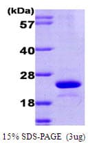 Human UBE2L6 Protein (Recombinant His)