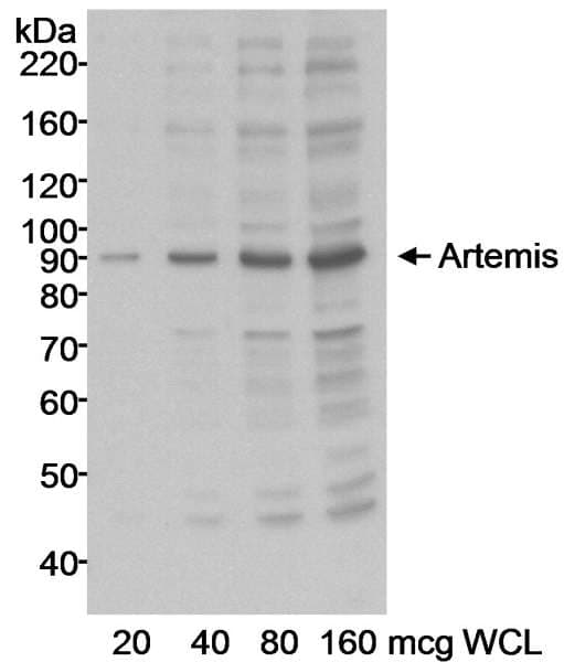 DCLRE1C / Artemis Antibody (aa650-C-term)