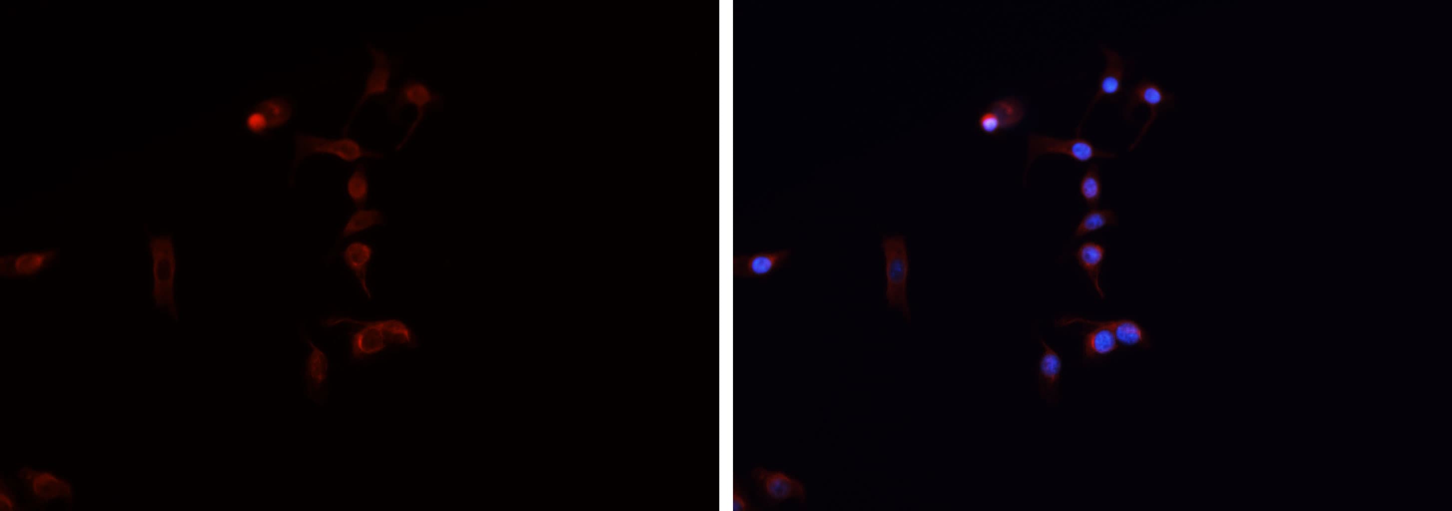 TPH1 / Tryptophan Hydroxylase Antibody