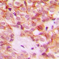 COL1A2 / Collagen I Alpha 2 Antibody (Internal)
