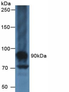 MUC16 / CA125 Antibody (aa13977-14117)