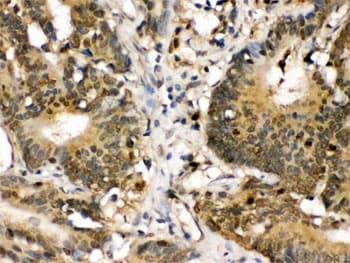 Polyclonal Rabbit anti-Human MAP2K3 / MEK3 / MKK3 Antibody (IHC, WB)