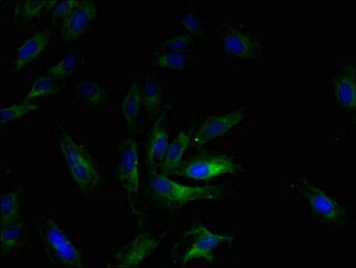 CCL2 / MCP1 Antibody