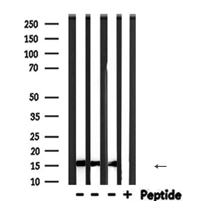 PFN1 / Profilin 1 Antibody