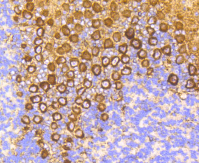 PRKCA / PKC-Alpha Antibody