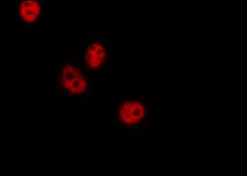 CREB1 / CREB Antibody (phospho-Ser142)