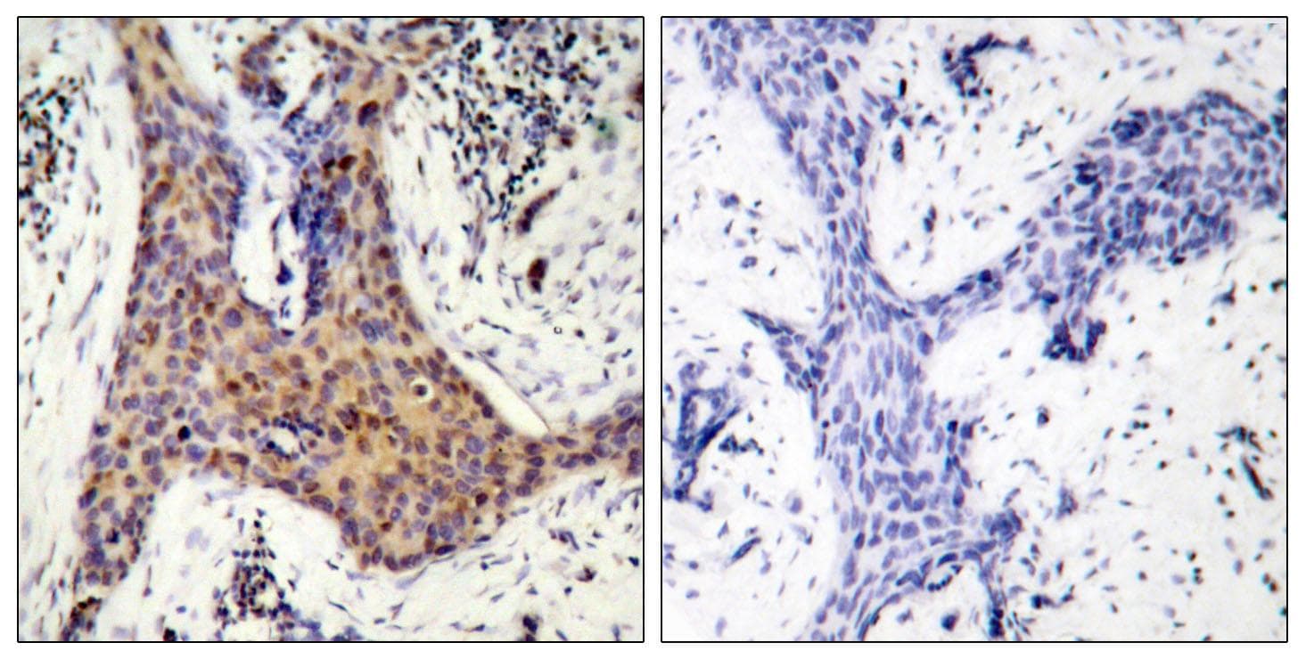 BAD Antibody (phospho-Ser136)