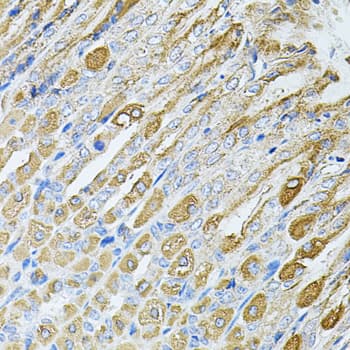 IHC-plus™ MTTP / MTP Antibody