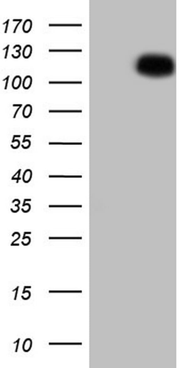 BSAC / MKL1 Antibody (aa165-397, clone OTI1B5)