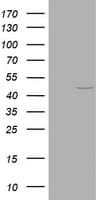 KRT20 / CK20 / Cytokeratin 20 Antibody (clone OTI6D5)