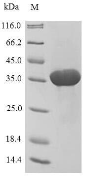 Taraxacum officinale Root allergen protein (Recombinant 10His-SUMO, N-terminus + Myc, C-terminus)