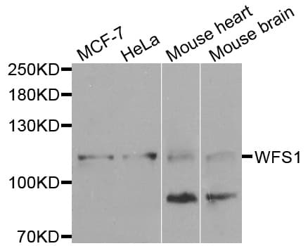 IHC-plus™ Polyclonal Rabbit anti-Human WFS1 Antibody (IHC, WB)