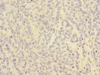 Polyclonal Rabbit anti-Human CD32C Antibody (IHC, WB)